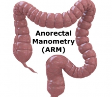 Anorektalna manometrija